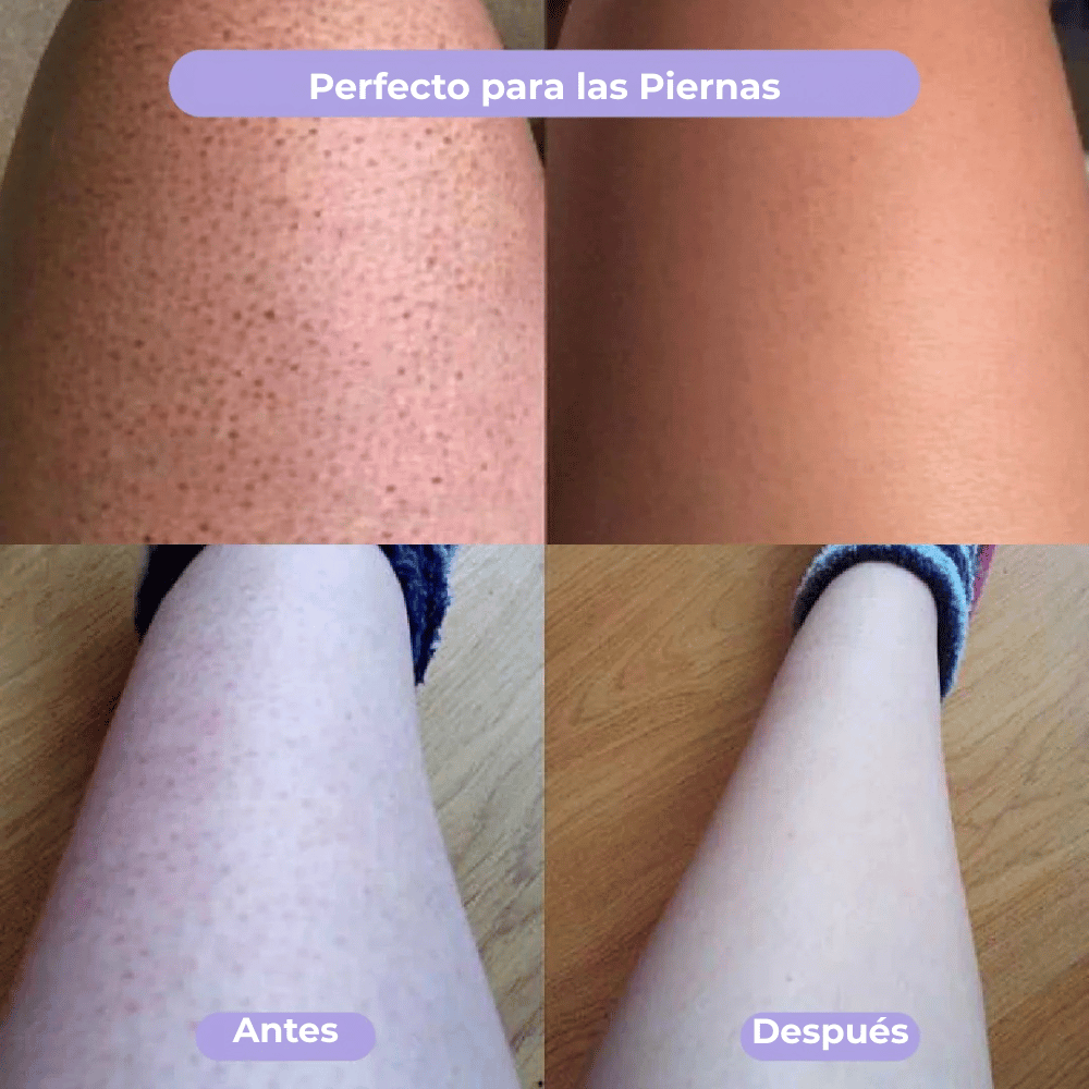 Luneva ByeVello™